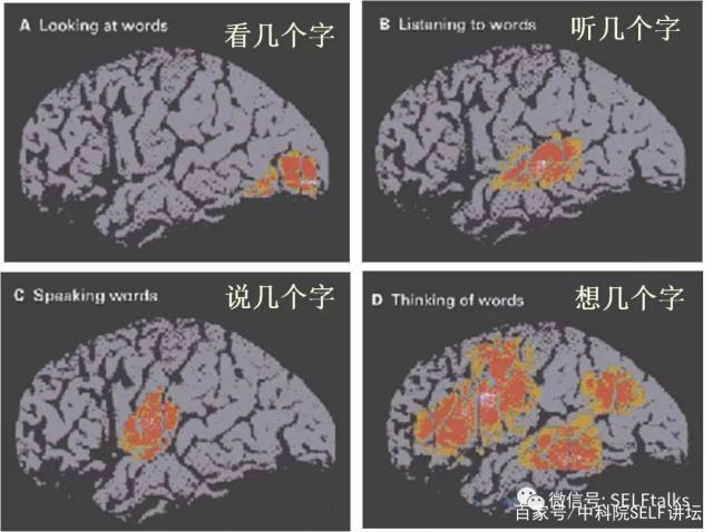 中國腦健康日關注“頭”等大事,中國腦科技的未來是什么?