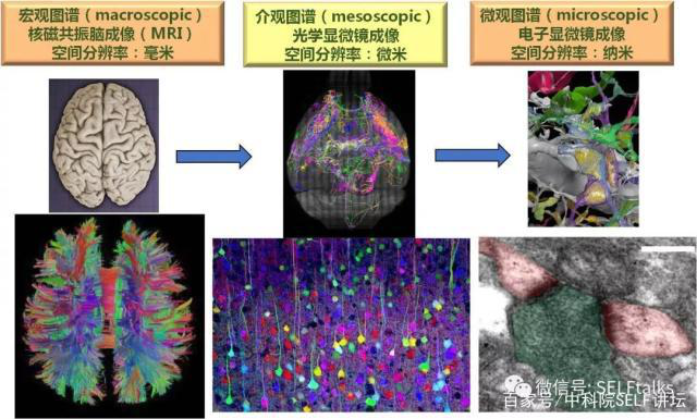 中國腦健康日關注“頭”等大事,中國腦科技的未來是什么?